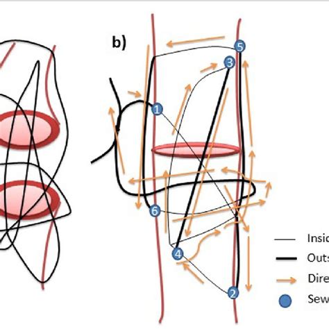 A C How The 3 Lp Suture Is Performed Download Scientific Diagram