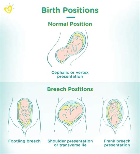 What You NEED To Know About the Shestorys Breach and the Burch Twins (Before It’s Too Late!) - cn6nkbf