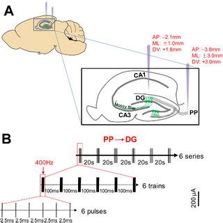 Schematic Representation Of The Brain Targets Of The Electrode Tip And