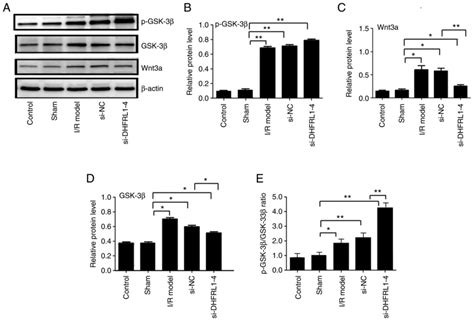 Lncrna Dhfrl Knockdown Attenuates Cerebral Ischemia Reperfusion