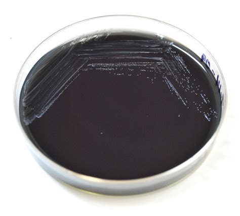 Legionella Pneumophila On BCYE Buffered Charcoal Yeast 55 OFF