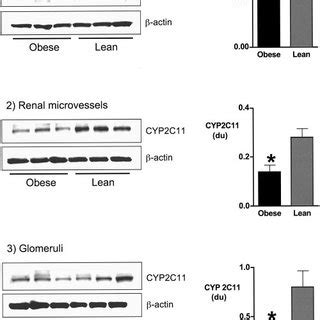 Left Renal Cortical Microvascular And Glomerular Seh