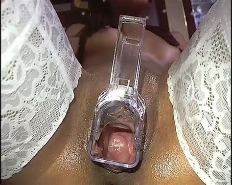 Polys Gaping Pussy Speculum Show Free Porn 84 XHamster XHamster