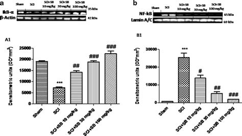 Effects Of Sb On Nf B Inflammatory Pathway Representative Western