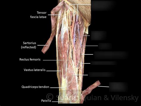 Cadaver Leg Muscles Labeled