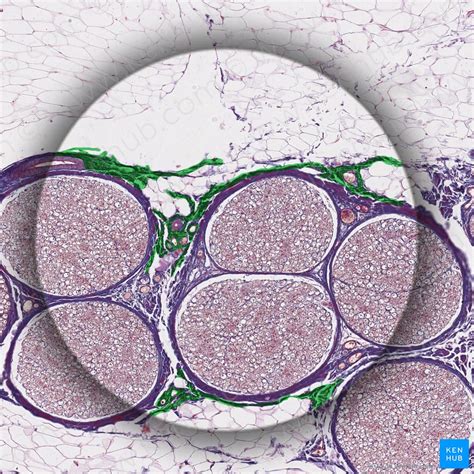 Histology of neurons: Morphology and types of neurons | Kenhub