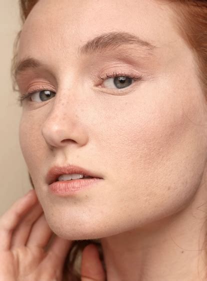 Neogen Plasma Treatment In North London Ambra Aesthetic Clinic Finchley