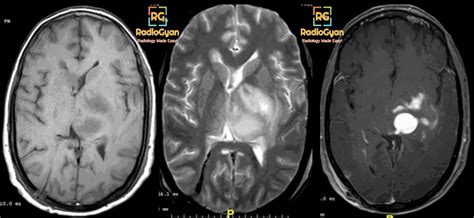 Radiology Cases Quiz Spotters Set Radiogyan Radiogyan