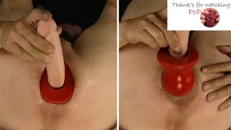 Pighole Xxl Oxballs Dildo Deep In My Ass Anal Hard Fucked Prolpase Rosebud Gay Porn
