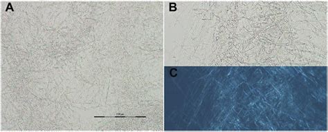 14 Optical Microscope Images All With 100 Mm Scale Bar Showing The