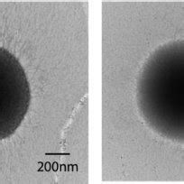 Transmission electron microscopic analysis of P. gingivalis fimbriae ...