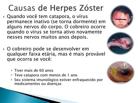 PPT Herpesvírus PowerPoint Presentation free download ID 2138084