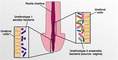 Healthy Men Who Have Vaginal Sex Have A Distinct Urethral Microbiome
