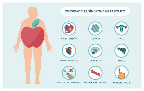 La Obesidad No Es Un Problema De Talla Sino De Salud Dieta Positiva