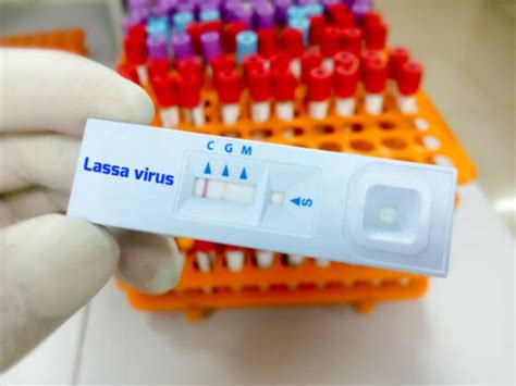 What You Need To Know About Lassa Fever Healthfacts