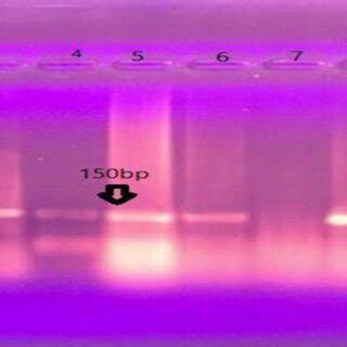 Ethidium Bromide Stained Agarose Gel Electrophoresis Of PCR Products