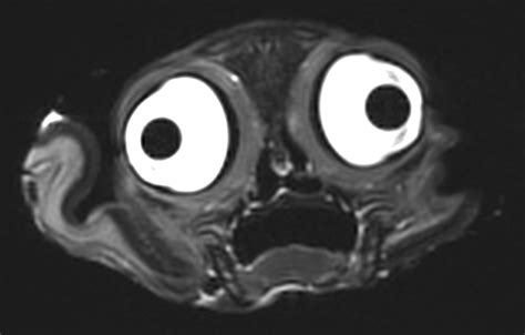 What Creature Made This Face In An Mri Machine Live Science