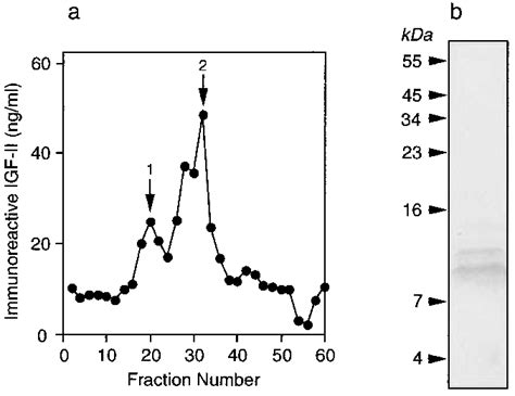 A Igf Ii Immunoreactivity In Igf Ii Secreting Tumour Tissue Extracted