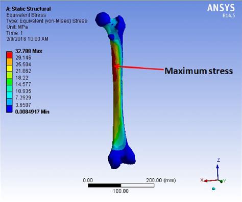 Von Mises Stress Distribution Of A Normal Femur Bone Region Download Scientific Diagram