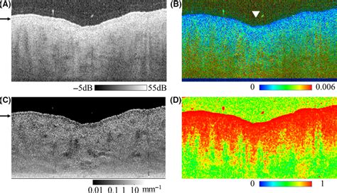 Tomographic Images Of Three Depthresolved Optical Properties A