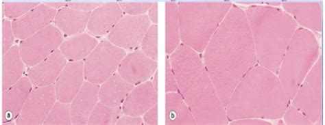 Lecture 1 - Cellular Adaptation, Injury, and Death Flashcards | Quizlet