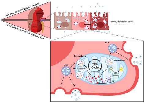 Acute Kidney Injury by Ischemia/Reperfusion and Extracellular Vesicles