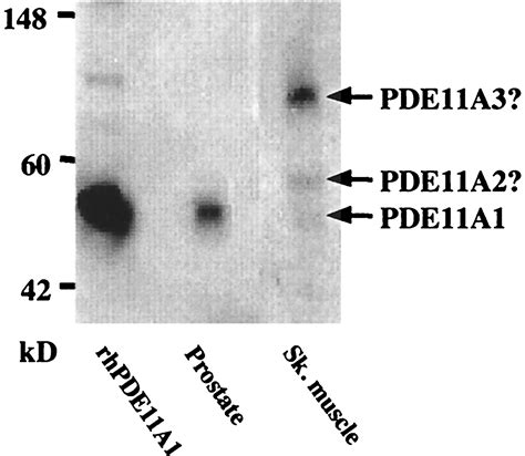 Molecular Cloning And Characterization Of A Distinct Human