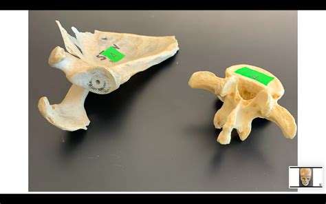 Solved Victim A Activity I Sex Determination From Pelvic Morphology Course Hero