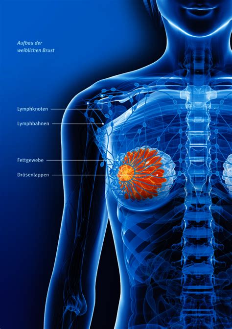 Brustkrebs Deutsche Krebshilfe
