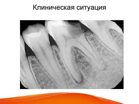 Лучевая диагностика в стоматологии - презентация онлайн
