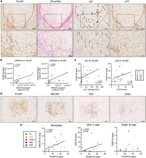 The Senescent Secretome Drives Plvap Expression In Cultured Human