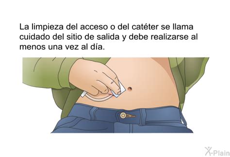 PatEdu Acceso de catéter para diálisis peritoneal