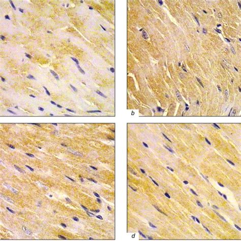 Expression Of Bcl 2 In LV CMC In Rats Immunohistochemical Staining