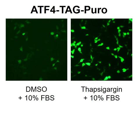 Fluorescent Atf4 Reporter Lipexogen Biotech