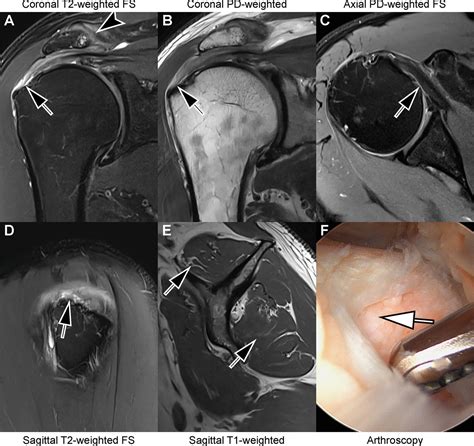 Arthroscopy-validated Diagnostic Performance of 7-Minute Five-Sequence