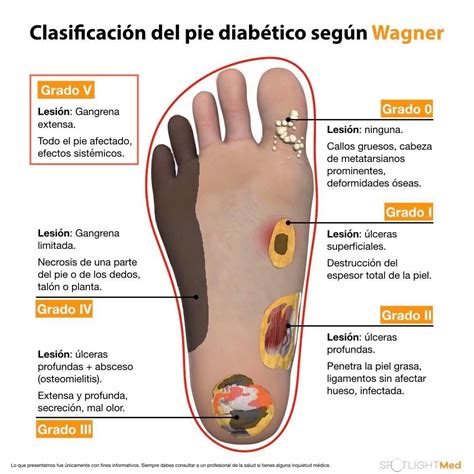 Fisiopatologia Do P Diab Tico Braincp