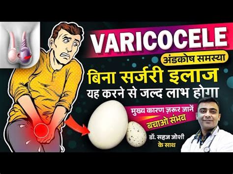 Varicocele Natural Treatment Varicocele Treatment Without Any Surgery