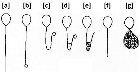 Reprod Med Free Full Text Hypo Osmotic Swelling Test And Male Factor