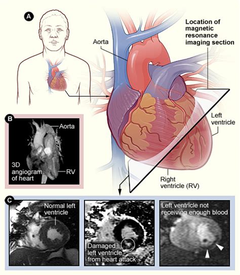 Cardiac Mri Examination: An Overview – QZEOF