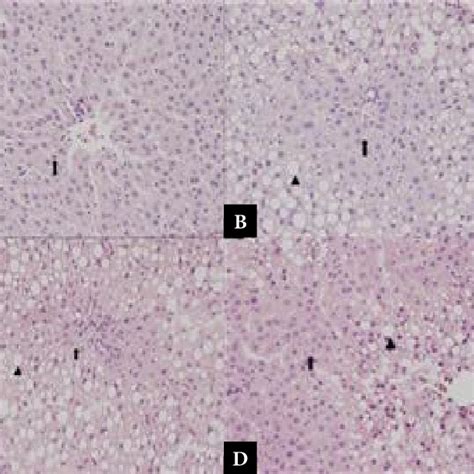 Photomicrograph Of Liver Sections A Normal Histological Appearance Of