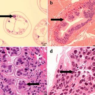 Histological Sections H E Stained Through Psorospermium Spp From