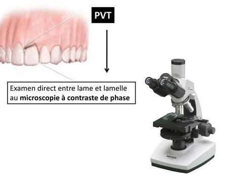 Protozoaires De La Cavité Buccale Ppt Télécharger