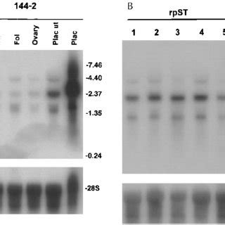 Autoradiograph of a Northern blot of somatotropin receptor mRNA and 28S... | Download Scientific ...