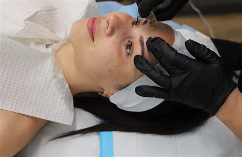 What Is A Prp Facial My Experience Before And After Isabelxmarie