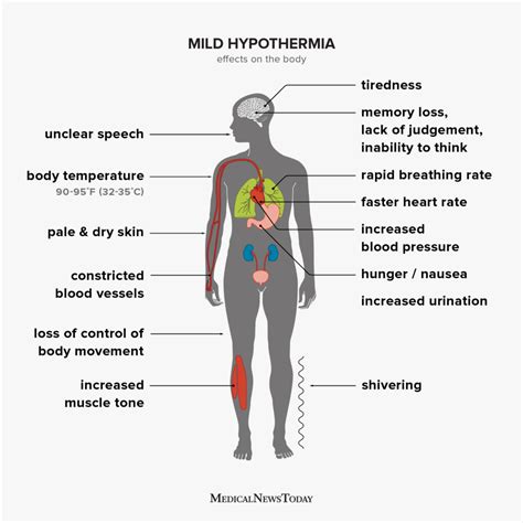 Hypothermia Symptoms Treatment Stages And More