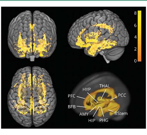 Figure From Sex Driven Modifiers Of Alzheimer Risk Semantic Scholar