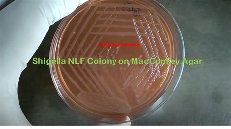 Non Lactose Fermenter Colony Of Shigella YouTube