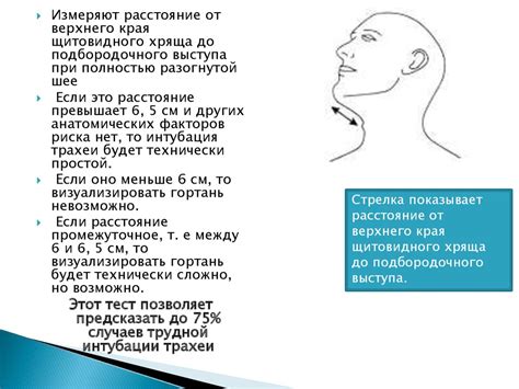 Интубация трахеи. Виды, техника, осложнения. Алгоритм трудной интубации ...