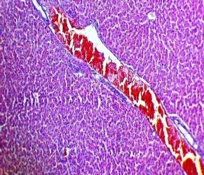 A Photomicrograph Of Section Obtained From The Liver Of Rat Treated