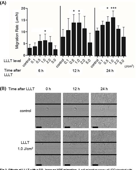 Figure From A Low Level Carbon Dioxide Laser Promotes Fibroblast